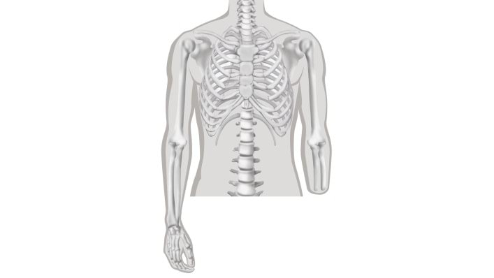 Unterarmamputation